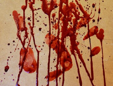 Ρωσία: Ένας 31χρονος τεμάχισε δύο γυναίκες και τις... τάισε σε σκυλιά (φωτό)